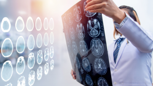 The Types and Causes of a Traumatic Brain Injury